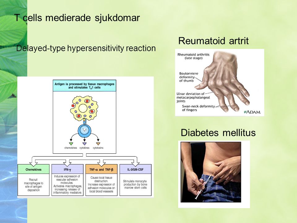 ... -type hypersensitivity reaction Reumatoid artrit Diabetes mellitus