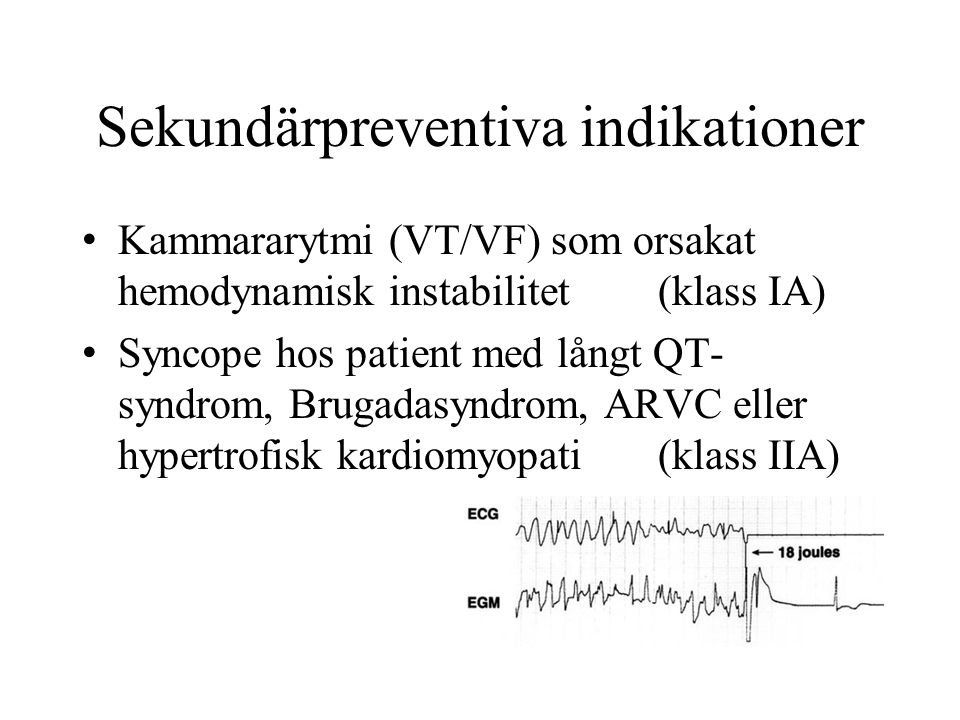 Sekundärpreventiva indikationer Kammararytmi (VT/VF) som orsakat hemodynamisk instabilitet(klass IA) Syncope hos patient med långt QT- syndrom, Brugadasyndrom, ARVC eller hypertrofisk kardiomyopati(klass IIA)