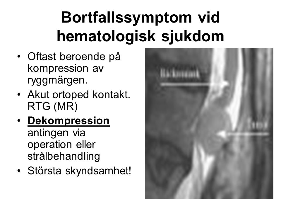 Bortfallssymptom vid hematologisk sjukdom Oftast beroende på kompression av ryggmärgen.