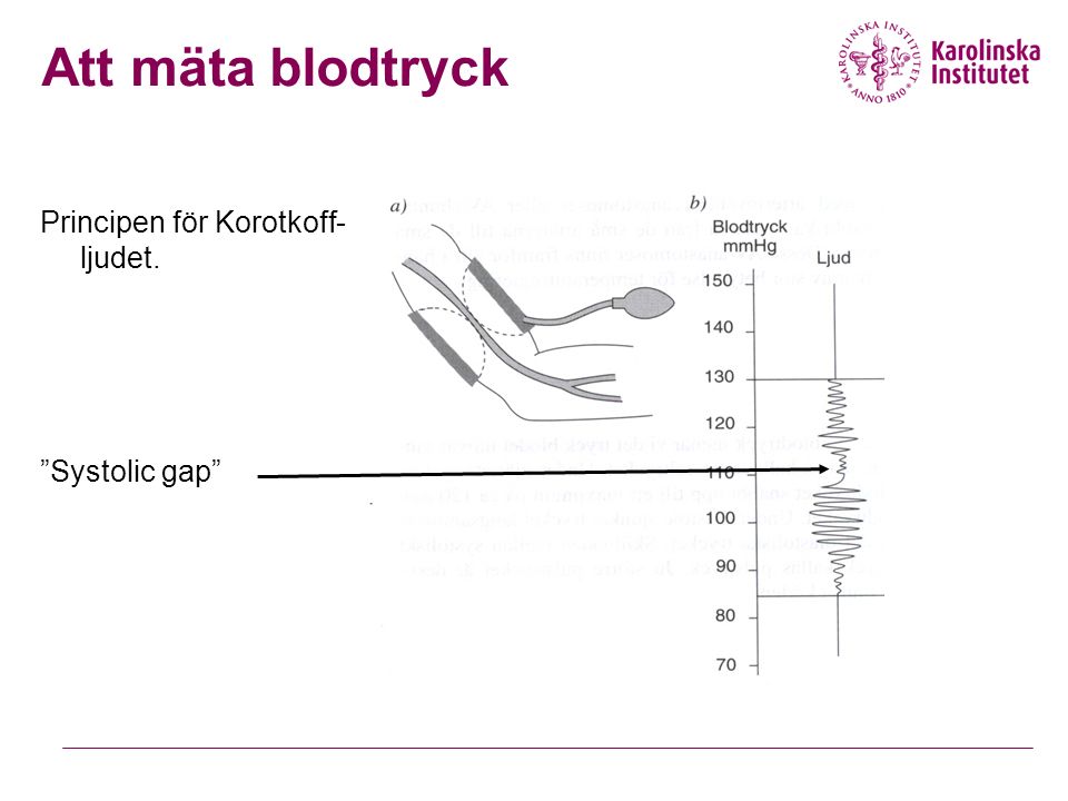 Principen för Korotkoff- ljudet. Systolic gap Att mäta blodtryck